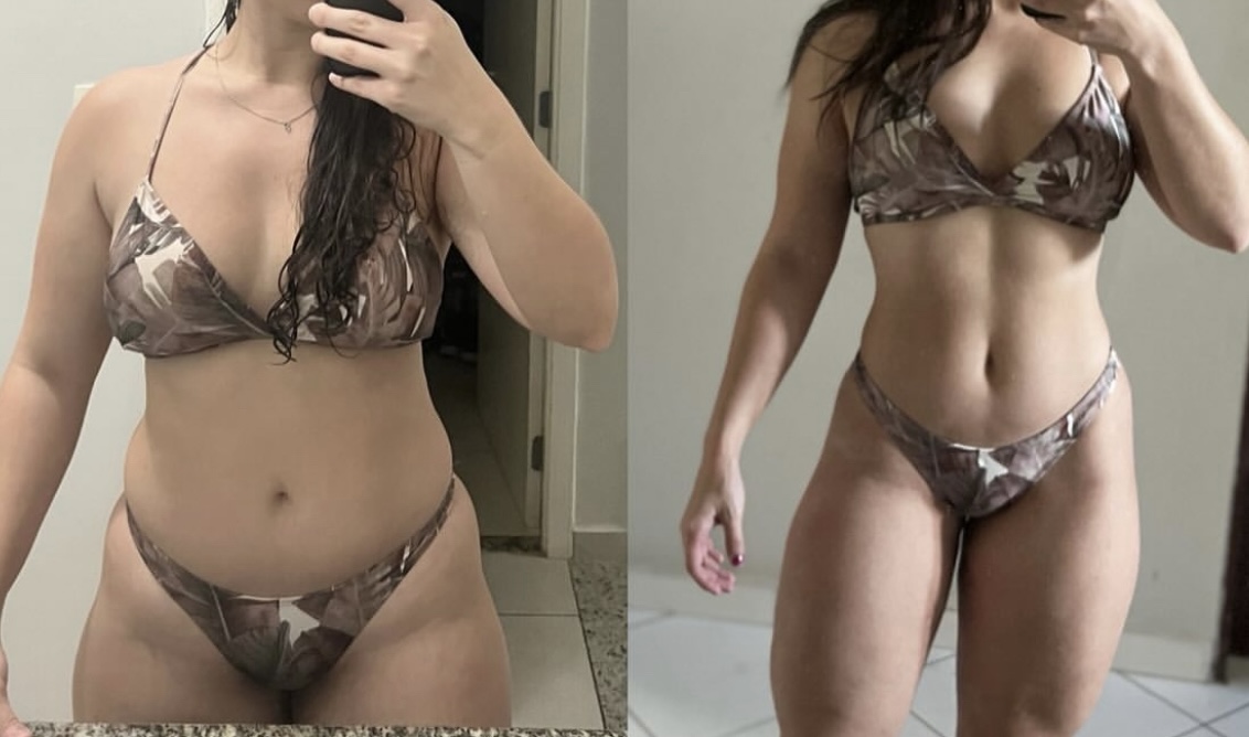 Resultado real 11 — comparativo antes e depois de um aluno acompanhado pela OmniFit