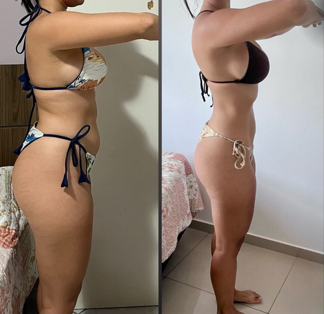 Resultado real 6 — comparativo antes e depois de um aluno acompanhado pela OmniFit