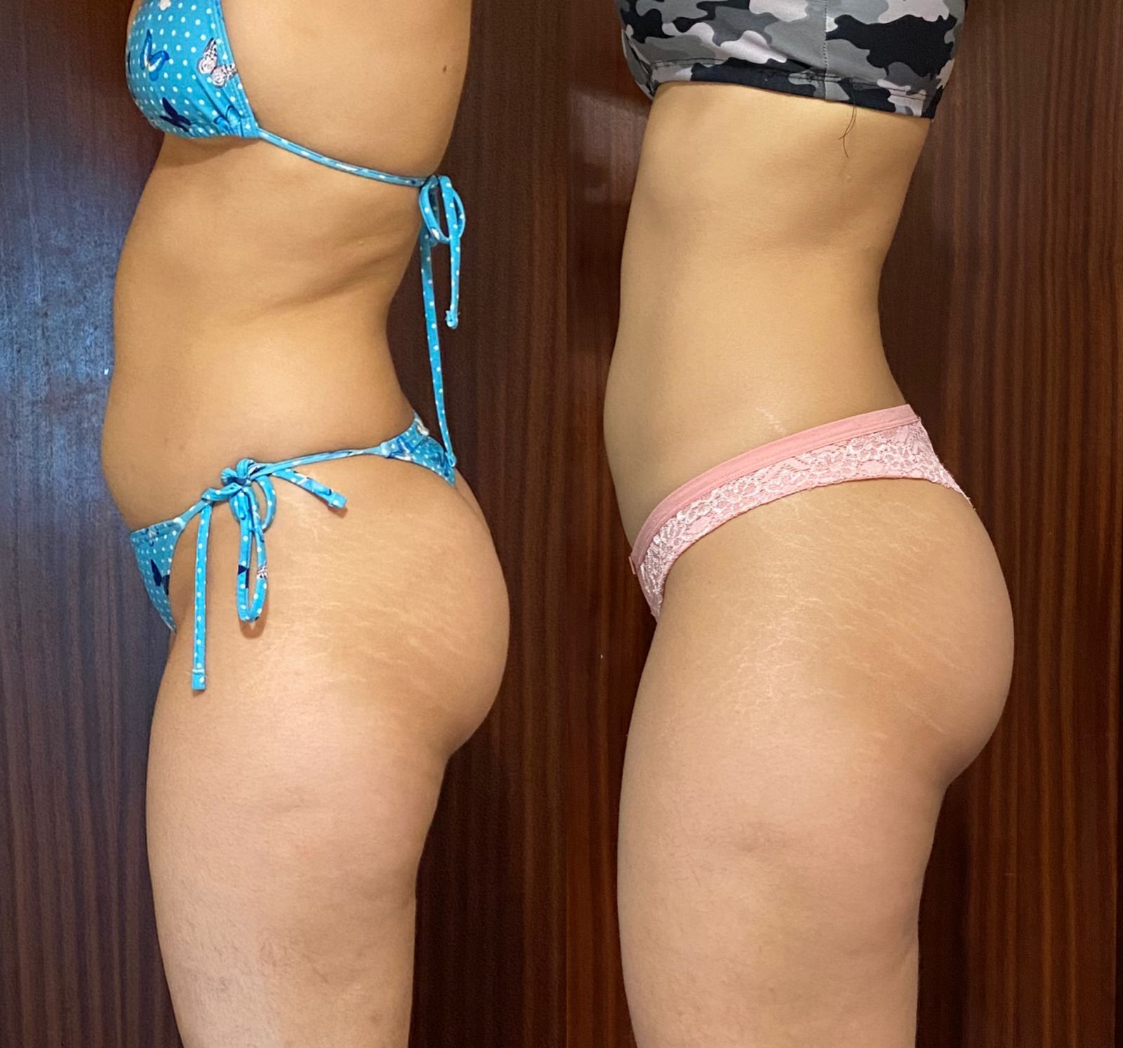 Resultado real 4 — comparativo antes e depois de um aluno acompanhado pela OmniFit