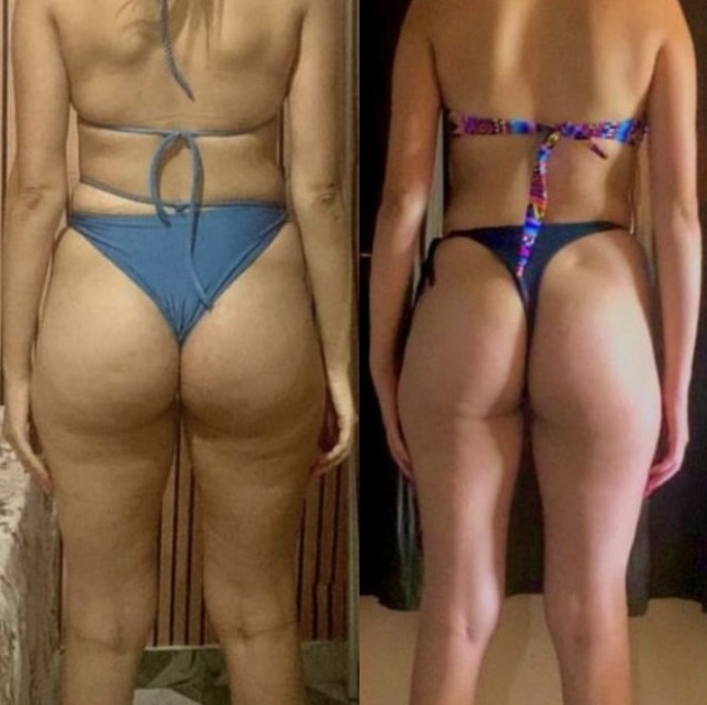 Resultado real 9 — comparativo antes e depois de um aluno acompanhado pela OmniFit
