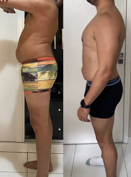Resultado real 16 — comparativo antes e depois de um aluno acompanhado pela OmniFit
