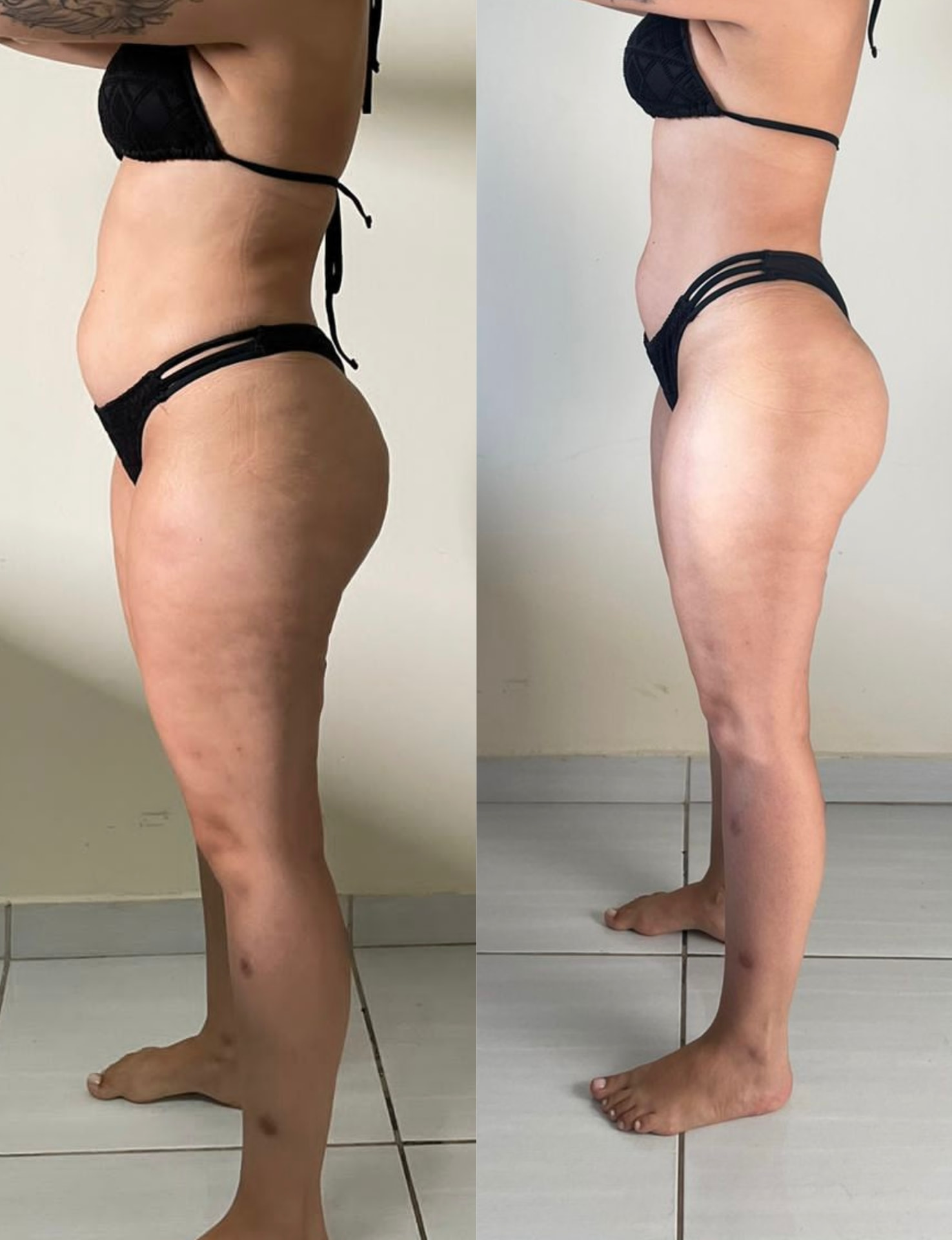 Resultado real 7 — comparativo antes e depois de um aluno acompanhado pela OmniFit