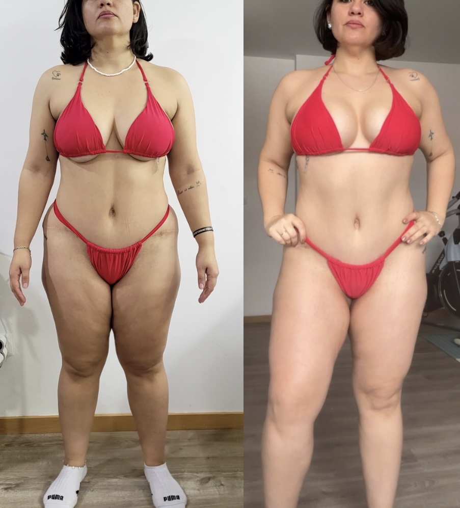 Resultado real 8 — comparativo antes e depois de um aluno acompanhado pela OmniFit