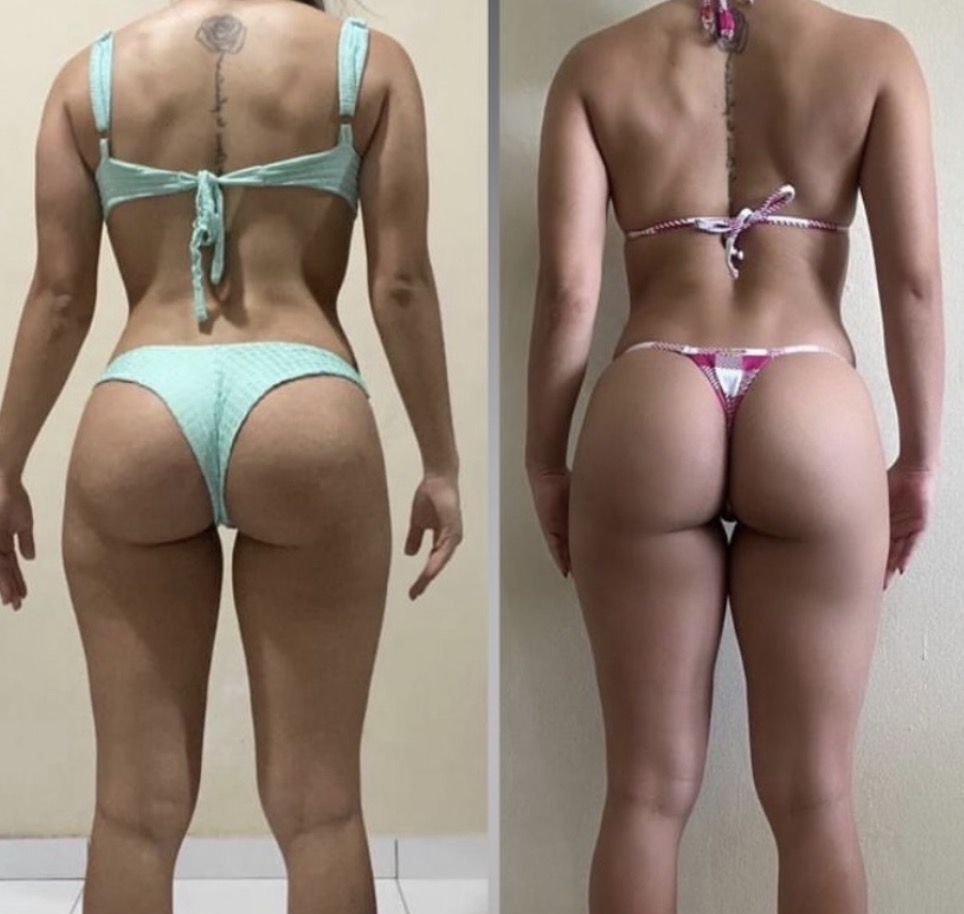 Resultado real 3 — comparativo antes e depois de um aluno acompanhado pela OmniFit