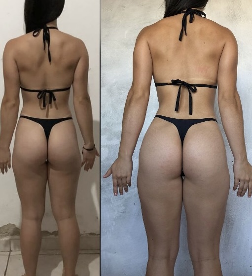 Resultado real 15 — comparativo antes e depois de um aluno acompanhado pela OmniFit