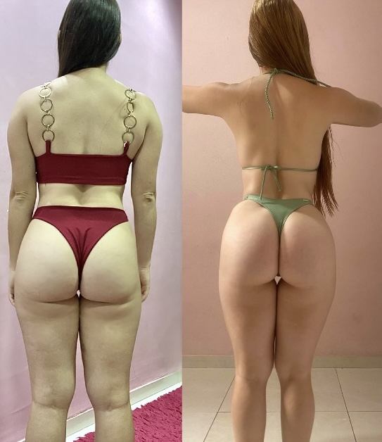 Resultado real 10 — comparativo antes e depois de um aluno acompanhado pela OmniFit